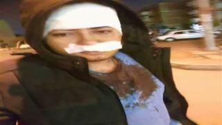 اسلام يروى تفاصيل نجاته من الموت على يد عصابه “اولكس” فى العاشر