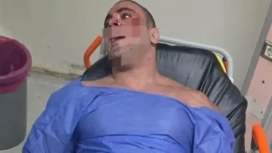 بطلق نارى.. حبس المتهم بإصابة مدير صالة جيم فى الشيخ زايد 4 أيام