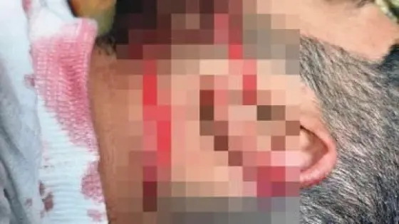 إصابة نجار موبيليا بجروح قطعية بعد اعتداء 4 أشخاص عليه في طوخ