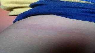 معلمة تتجرد من الإنسانية والرحمة وتعتدي علي تلميذ بسلك كهرباء والتعليم يحيلها للتحقيق