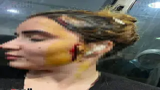 اعتداء بالسكين على فتاة بالعجوزة يشوه وجهها والقبض على المتهم