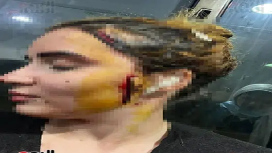 اعتداء بالسكين على فتاة بالعجوزة يشوه وجهها والقبض على المتهم