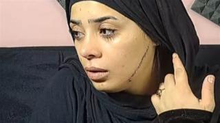 جهات التحقيق تنظر اليوم استئناف مريم المتهمة بتشويه وجه عروس مصر القديمة