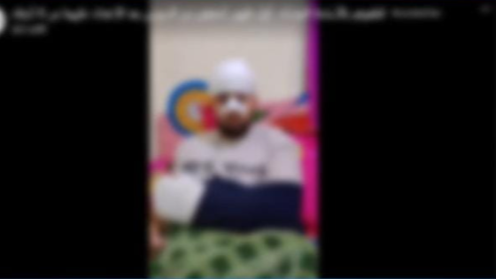 السويس: ضبط طرفي مشاجرة بالأسلحة البيضاء بعد تداول فيديو على مواقع التواصل