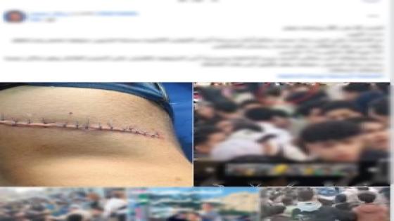 ​سقوط “طالبي السلاح الأبيض” بالمنوفية بعد إصابة زميلهما