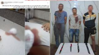 خلاف على تقسيم الميراث يتسبب فى 4 مصابين وبتر فى كف يد أحدهم بالبحيرة