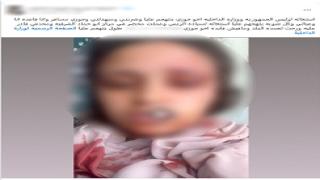 كشف ملابسات فيديو تعدي شقيق زوج على ربة منزل بالشرقية.. وضبط المتهم