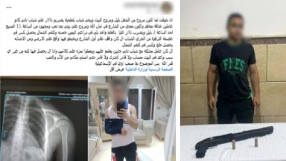 كشف ملابسات إصابة شخص بطلق ناري تصادف مروره بجوار مشاجرة بالإسماعيلية