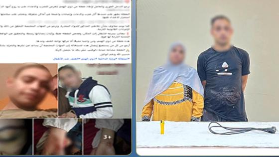 ضرباها وكيّا جسدها.. ضبط والدة فتاة من ذوي الهمم وزوجها بالجيزة