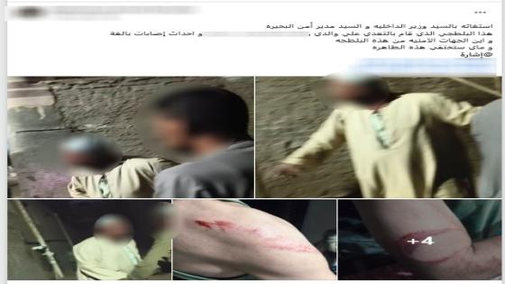 ضبط تاجر اعتدى على والد زوج شقيقته بالضرب بسبب خلافات الميراث في البحيرة