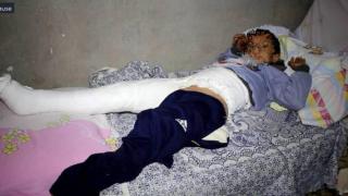 تلميذ الابتدائى يسقط بطلق طائش داخل المدرسة فى المنيا