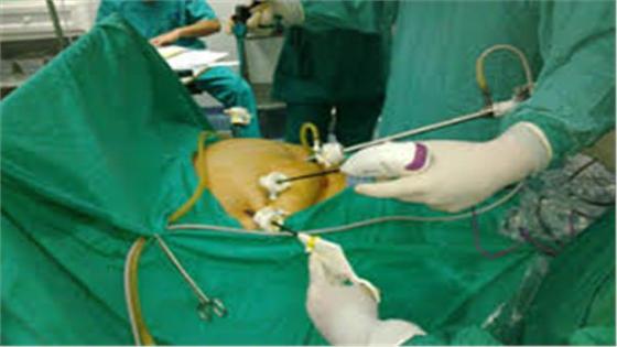 عملية تكميم المعدة تقود جزار طنطا للموت
