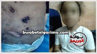 تأجيل محاكمة أم وعشيقها بتعذيب طفلتها لجلسة 14 مارس الجارى