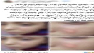 القبض على مدرسة حرقت وجه طالب بالولاعة ومنعته من دخول الحمام بسوهاج