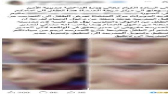 القبض على مدرسة حرقت وجه طالب بالولاعة ومنعته من دخول الحمام بسوهاج