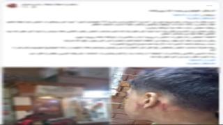 الداخلية تكشف ملابسات تعدي عامل على شاب بآلة حادة في الإسكندرية