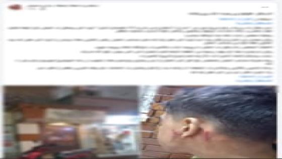 الداخلية تكشف ملابسات تعدي عامل على شاب بآلة حادة في الإسكندرية