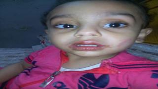 بلاغ يتهم صاحبة حضانة بتعذيب طفل وسحلة بالاسماعيلية