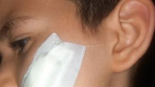 سلاح التلميذ .. طالب ثالثة ابتدائي ضرب زميله بـ”كتر” وسبب له عاهة مستديمة